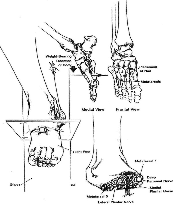 Las heridas del pie de Jesús en la parte central del pie de la estatua de Nabucodonosor. 